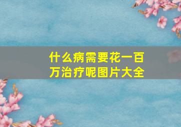 什么病需要花一百万治疗呢图片大全