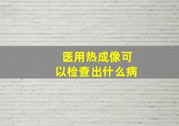 医用热成像可以检查出什么病