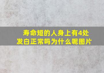 寿命短的人身上有4处发白正常吗为什么呢图片