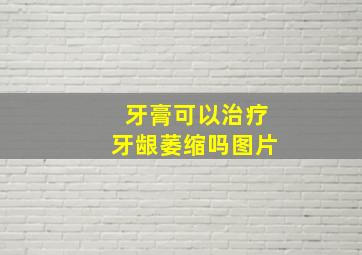 牙膏可以治疗牙龈萎缩吗图片