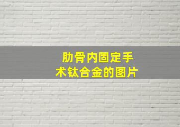 肋骨内固定手术钛合金的图片