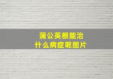 蒲公英根能治什么病症呢图片